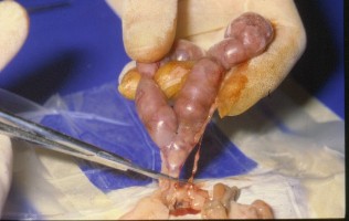 Discarded fallopian tube could be rich source of stem cellsDiscarded fallopian tube could be rich source of stem cells