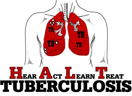 Treatment for drug-resistant tuberculosis found 