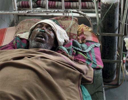 Hepatitis Outbreak: 8 New Cases Reported In Gujarat’s Sabarkantha Region