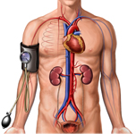High Blood Pressure