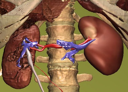 Kidney disease treatment may be improved by newly identified genes