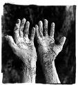 Archaeologists find oldest evidence of leprosy in India