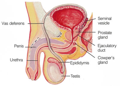 male infertility