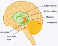 Parkinson's Disease