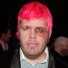 Perez Hilton allegedly beaten bloody by will.i.am