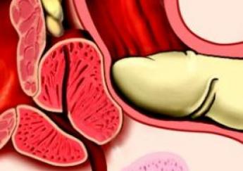 Senior men are unnecessarily being tested for prostate cancer, study