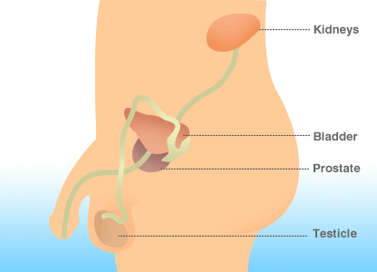 Prostate cancer patients on hormone therapy ''at increased heart disease risk''