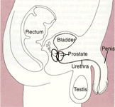 Prostate Cancer