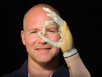 prosthetic-hand225.jpg