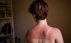  Drug to prolong lives of skin cancer patients soon to be widely available