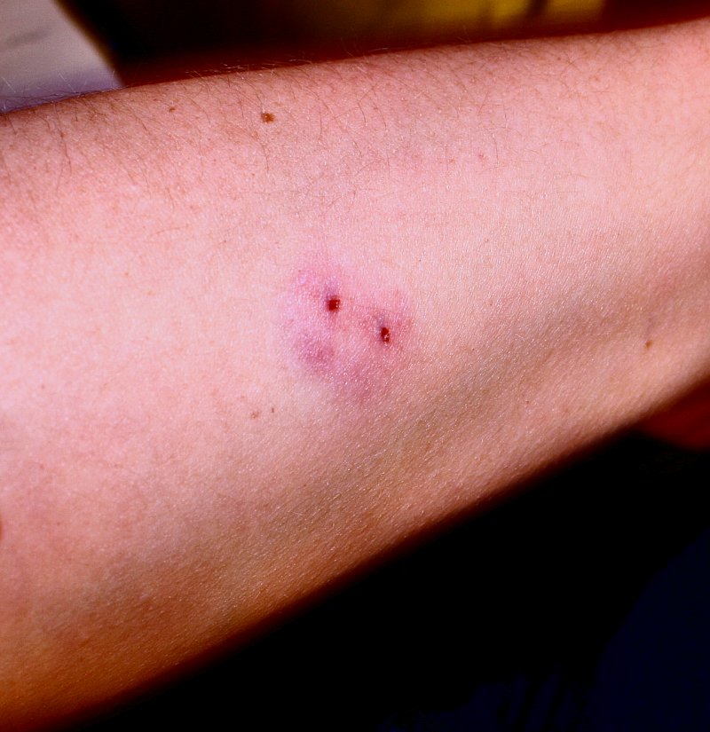 Prevention is the best way to reduce snakebite risk