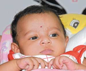 After Rare Surgery, Infant Gets New Life!