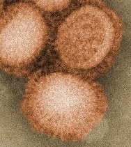 Mohali Reports First Swine Flu Death
