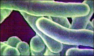 Indian scientists propose ‘electronic nose’ to detect TB from urine