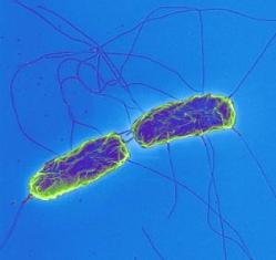 new study has suggested that typhoid bacteria gather up bilestones ... new study has suggested that typhoid bacteria gather up bilestones ...