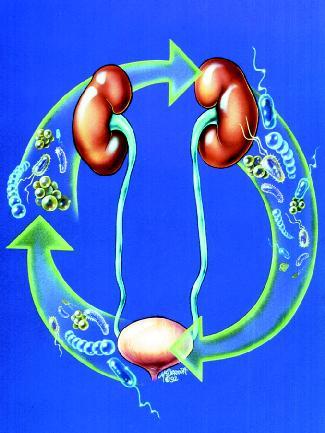 urinary tract infections