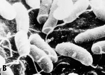 ‘Toxic’ sea bacteria by-product modified to use as potential cancer drug