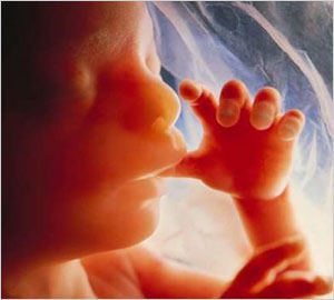 Abortions worldwide decline, study shows