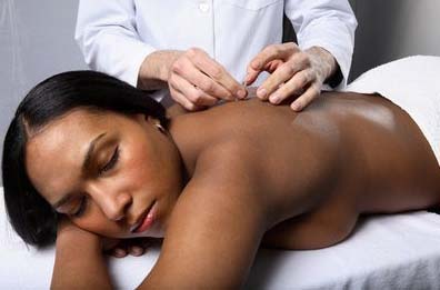 Acupuncture