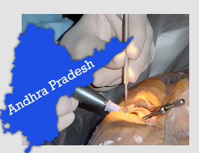 Andhra orders probe as 10 lose sight after surgery