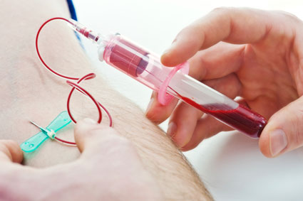 Blood test to detect pancreatic cancer early?