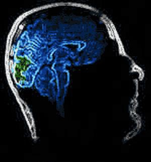 Brain Chip Created To Help Paralyzed Patients To Move Bionic Limbs