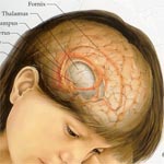 Genetic mutations linked to childhood brain cancer identified
