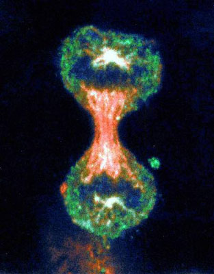 Cervical Cancer Cell