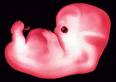 'Designer baby' to be free from breast cancer  