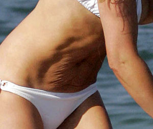Flabby tummies are women’s ‘worst body hang-up’