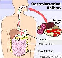 New Hampshire woman may have got gastrointestinal anthrax from African drum