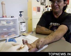 Drug resistant HIV 'spreads between people without anti-retroviral treatment'