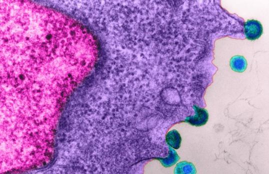 UK has legal HIV test 'home kits'