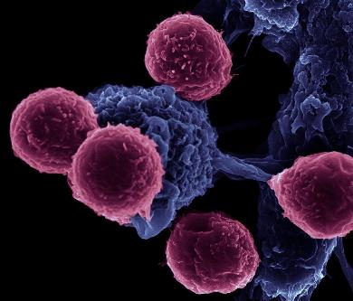 Immune cell
