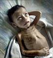 U.N. Funds To Help Nepalese ‘Fight Critical Malnutrition Levels’ 