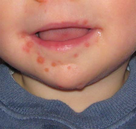 Singapore acts to halt spread of hand, food and mouth disease 