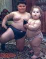 A new implant to block fat absorption, reduce obesity