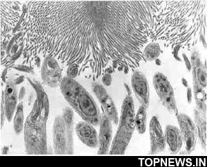 Leishmania parasites undergo sexual reproduction in sand flies