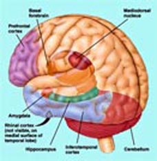 Daily marijuana intake leads to psychosis, schizophrenia