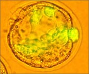 How stem cells could be used to repair damaged heart
