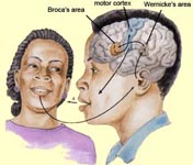 Auditory Cortex