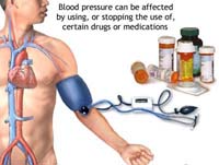 Study: Fifty percent people are unaware of their high BP problem
