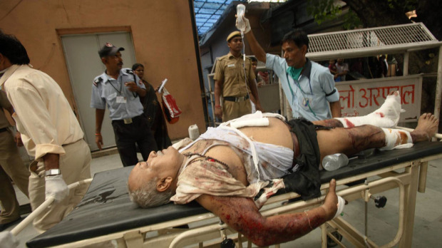 Blast Survivors Suffered Severe Injuries