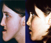 Cosmetic Surgery