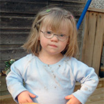 Child with Down syndrome