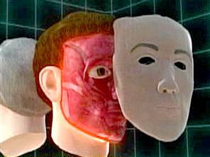 Face Transplant Patient Doing Well