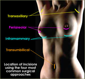 female_breast_cancer