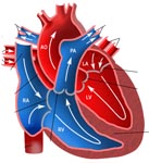 Hypoplastic Left Heart Syndrome