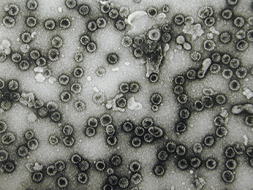 HPV virus aids cervical and head and neck cancer progression