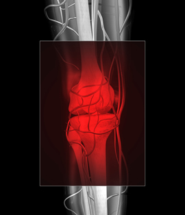 Strength training, self-management could effectively treat knee osteoarthritis